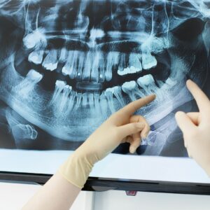 A periodontist reviews an x-ray
