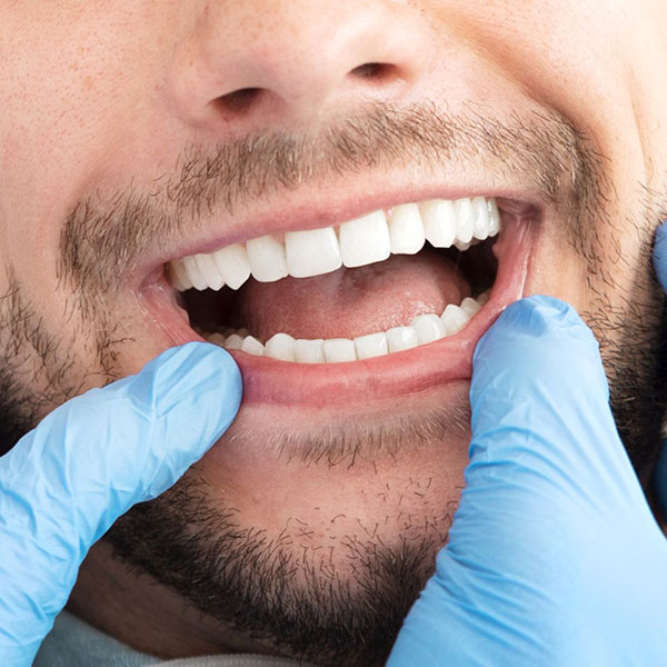 An image of patient's healthy gums after gum disease treatment